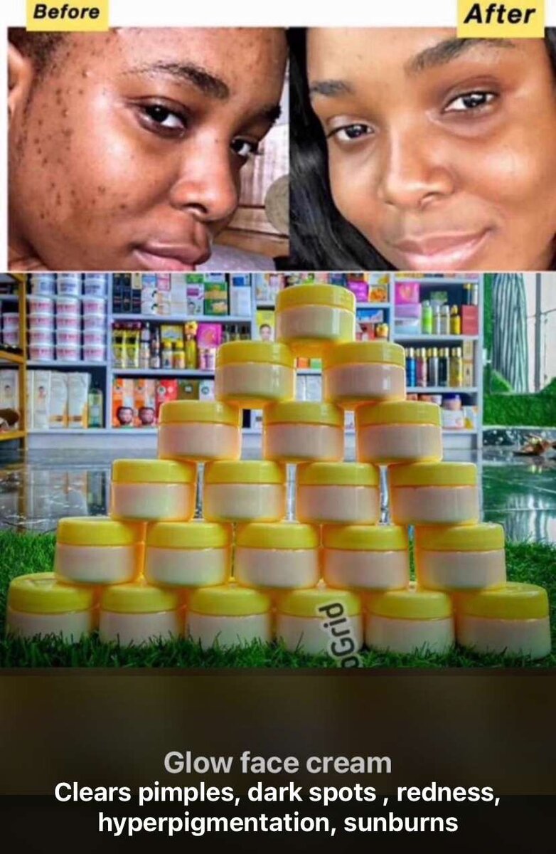 Efffective facial cream