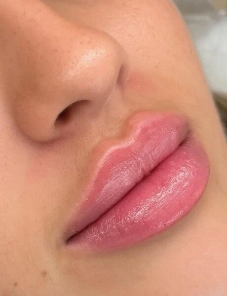 Ensemble de soins pour lèvres