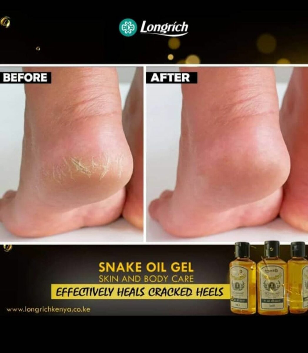 Miracle Snake Oil - 80ml