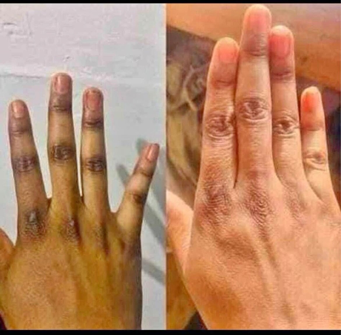 Lotion peeling très efficace