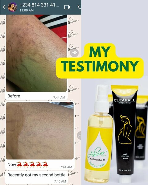 Ahum oil and Clearall balm