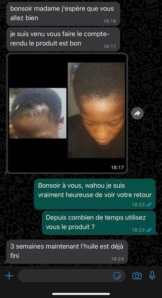 Huile Croissance Cheveux Rapide