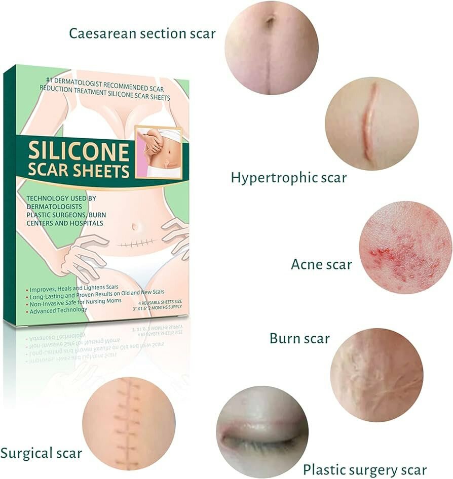 Silicone Scar sheet