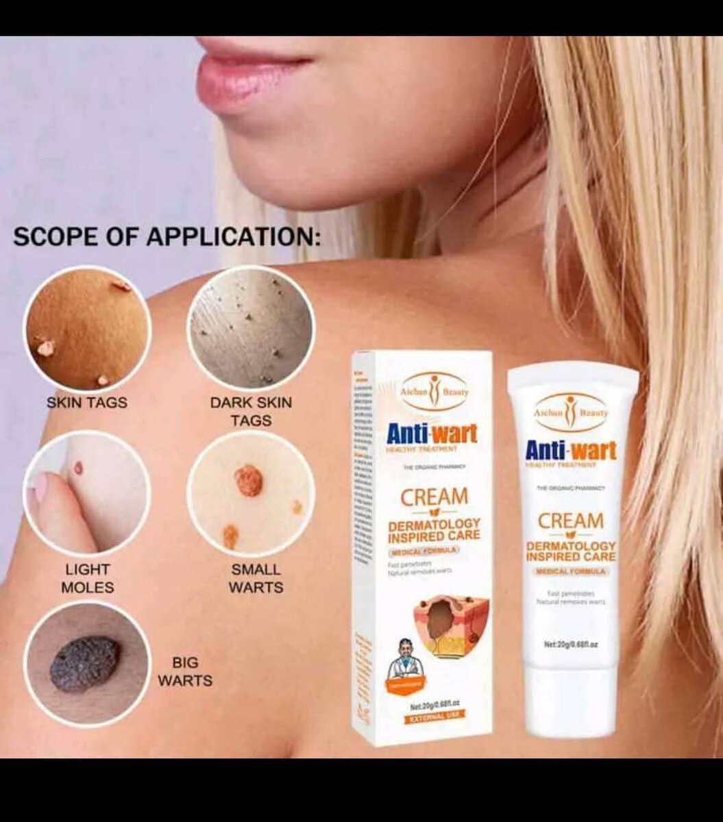Anti wart/Skin tag cream