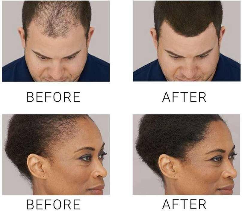 Toppik Fibres Capillaires Noires