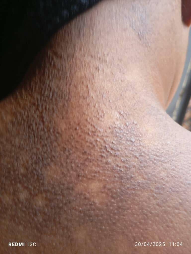 Crème Kératose Mami goudron