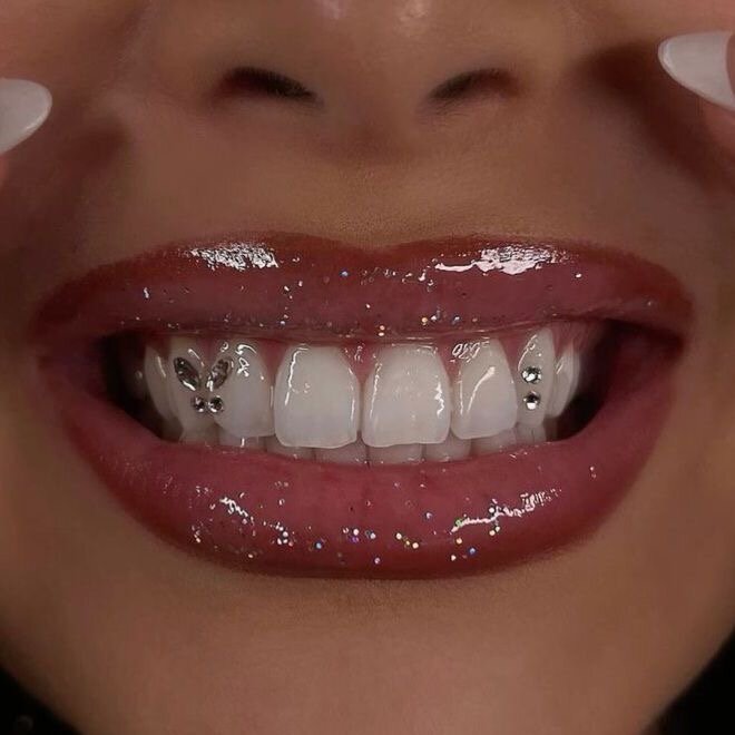 Kit strass dentaires