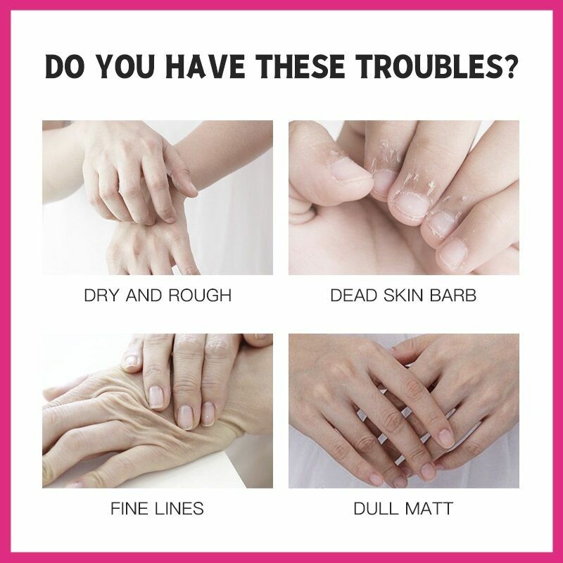 Vaseline cream anti-kantos