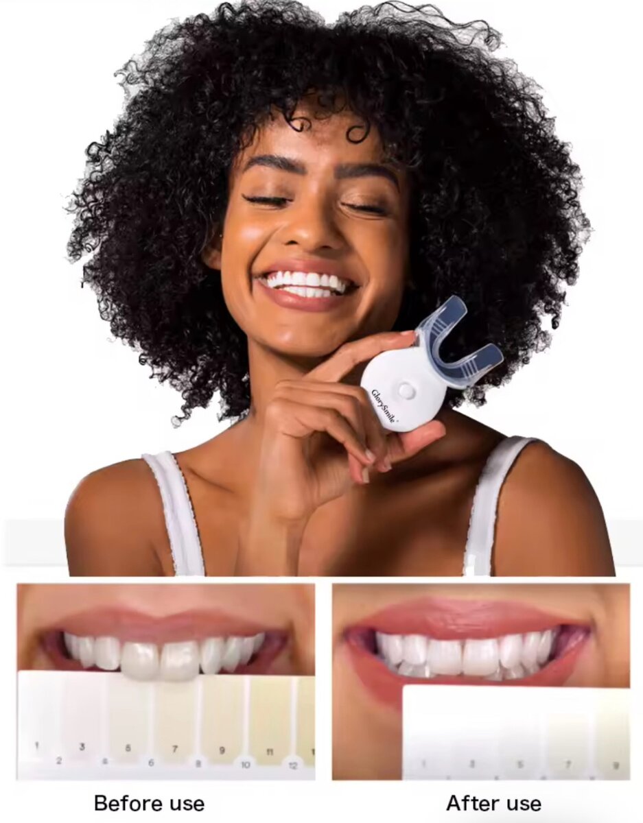 GlorySmile Kit Blanchiment Dentaire