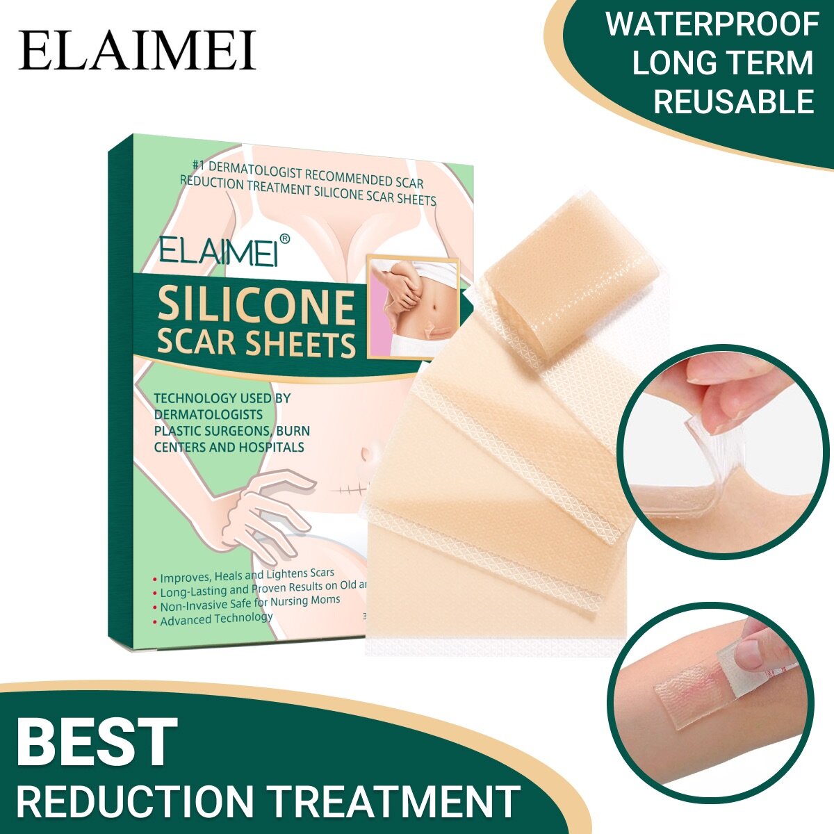 Silicone Scar sheet