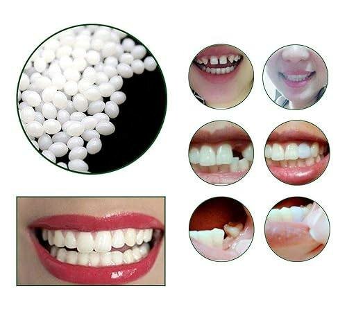 Temporal tooth beads