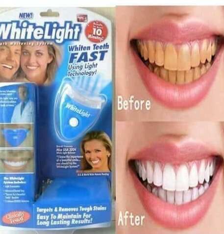 Kit De Blanchiment Dentaire