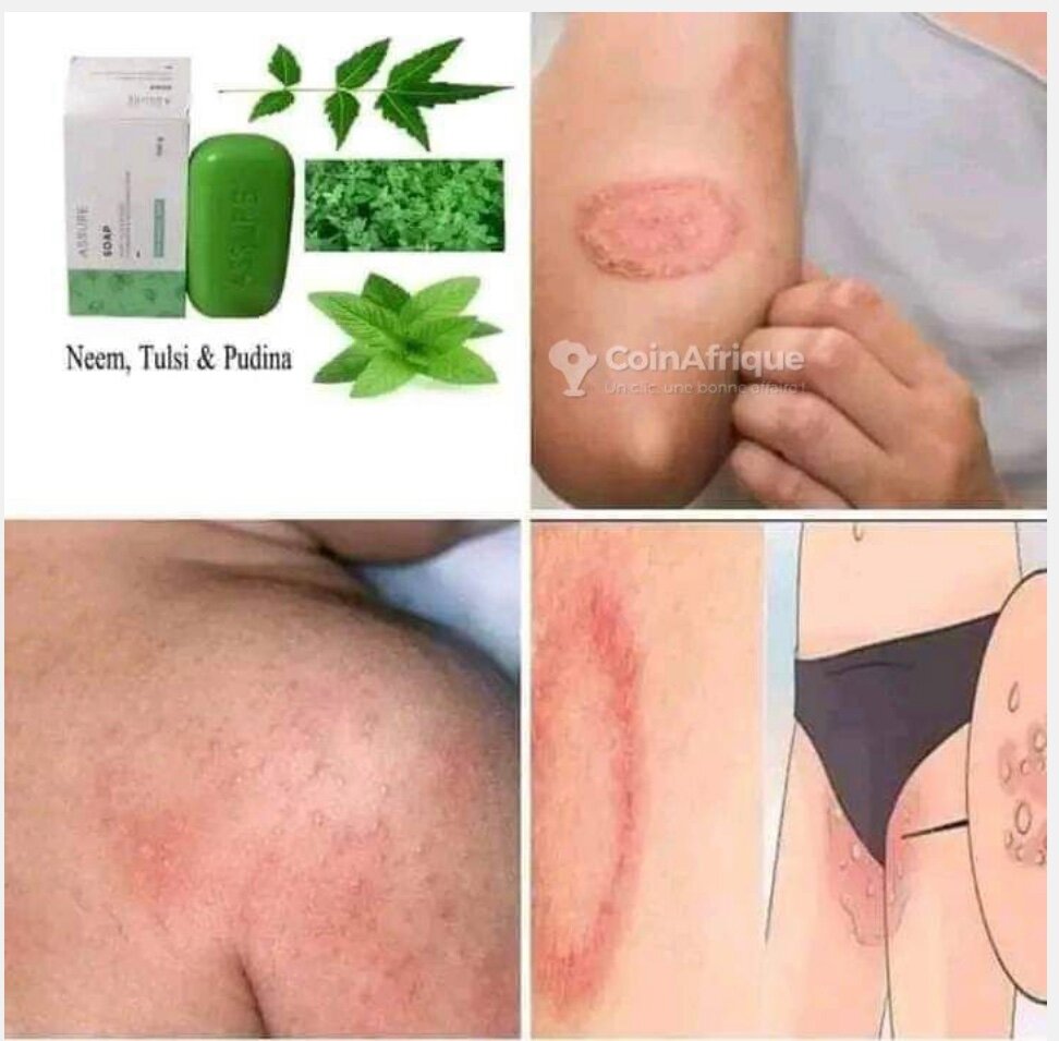 Savon Assuré à base de Neem