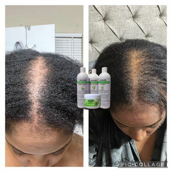 Rhabs Aloe Vera Hair Growth & Treatment Set