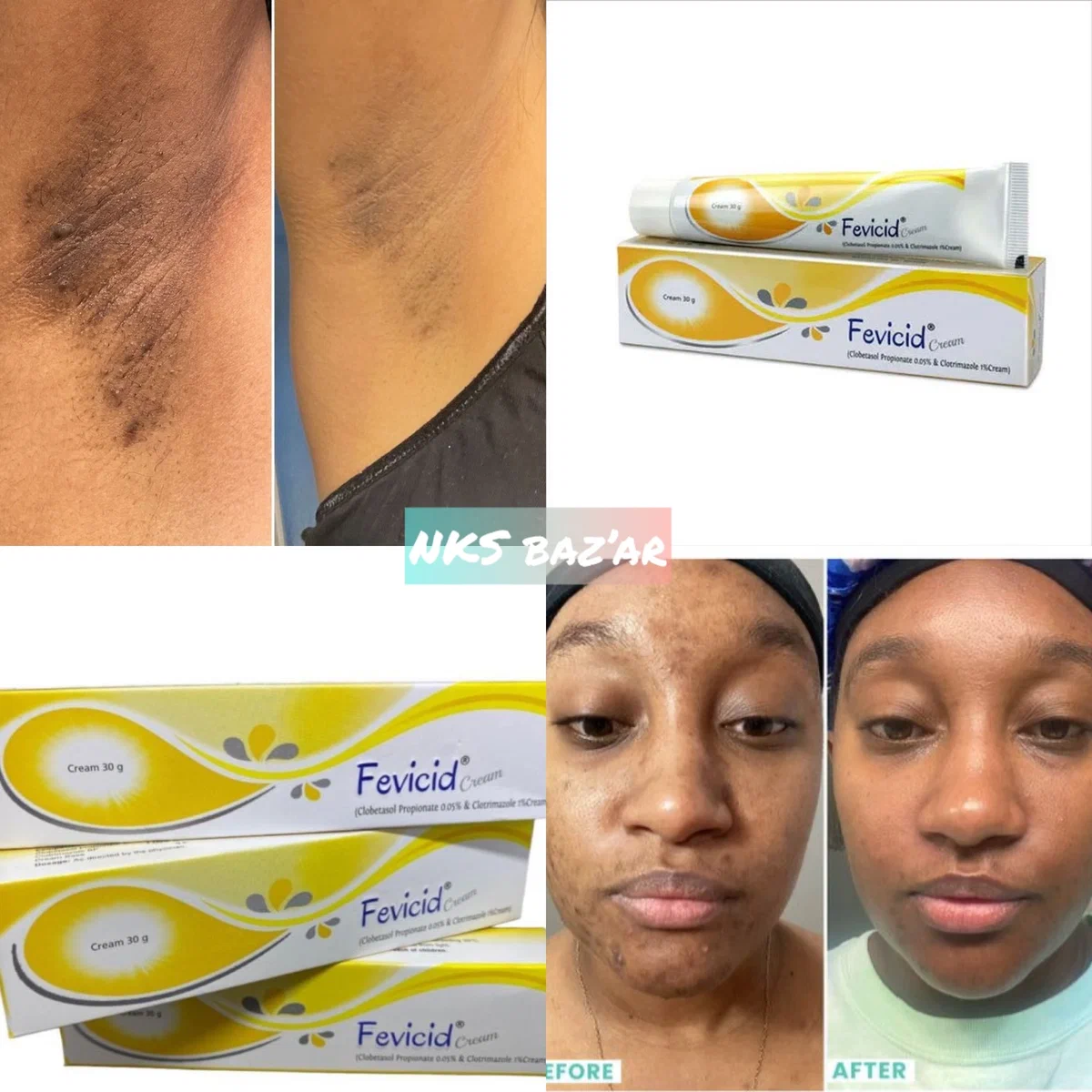 Fini les taches, acnés et autres à partir de 3 jours