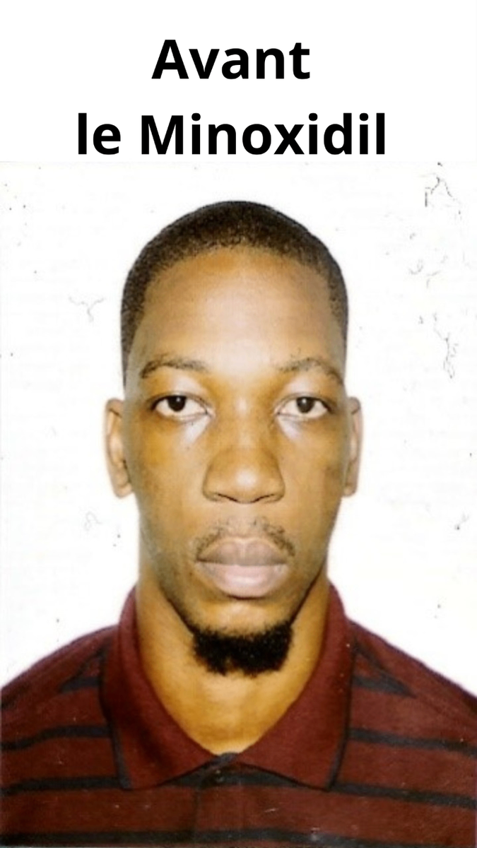 Barbe allant de zéro