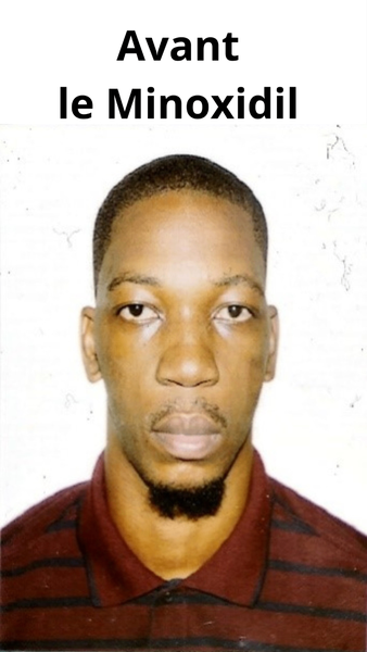 Barbe allant de zéro