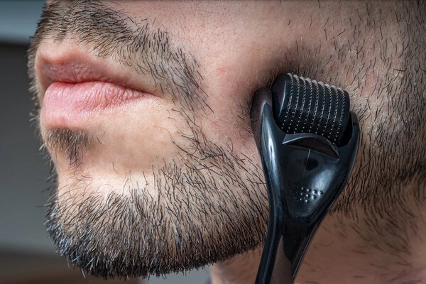 Derma roller