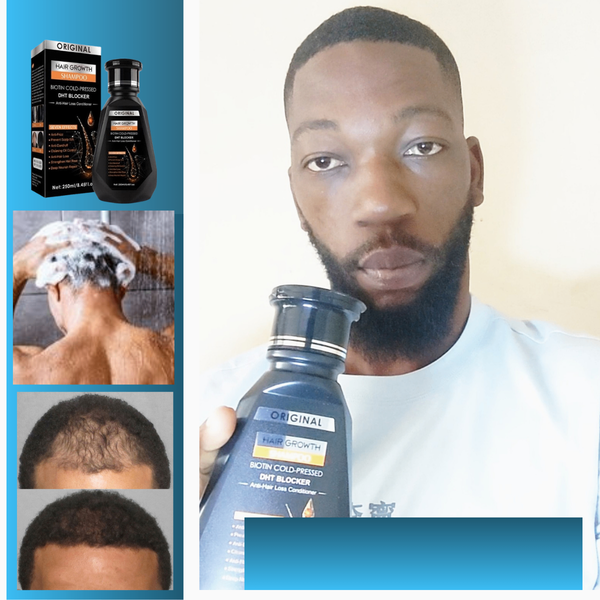 Shampoo anti-chute cheveux