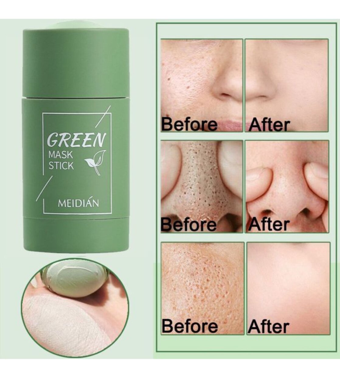 Facialmask black spot and acne