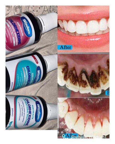 Wisdom mouth wash