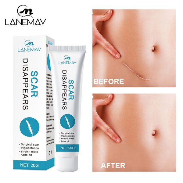 Scar Remover