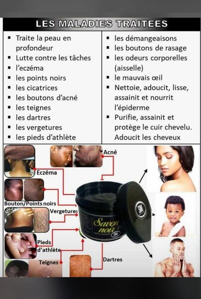 Savon Noir Pour Peau Parfaite