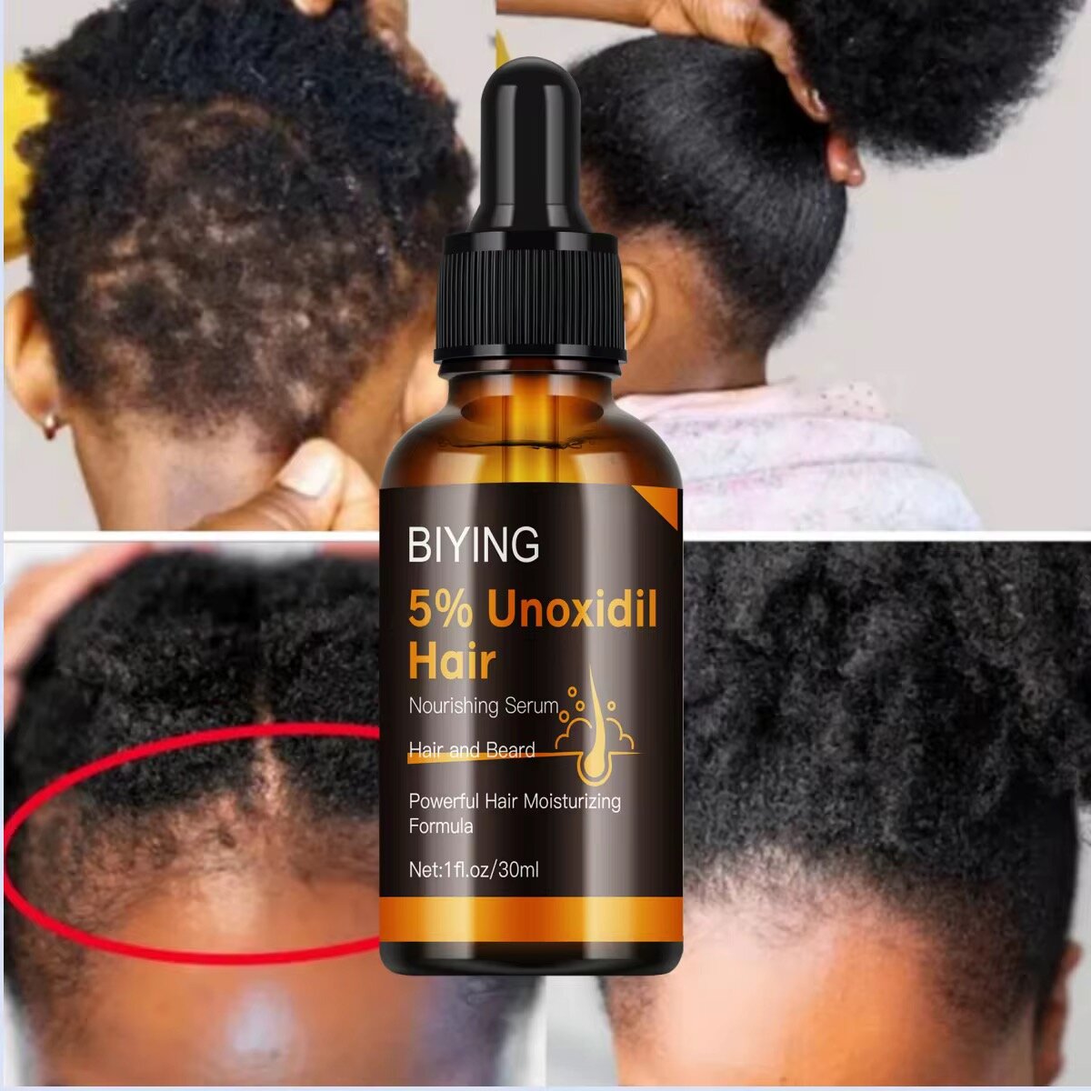 Sérum Capillaire BIYING Unoxidil 5%