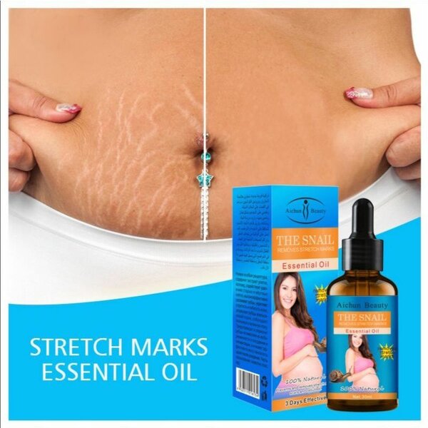Stretch Marks removal Oil