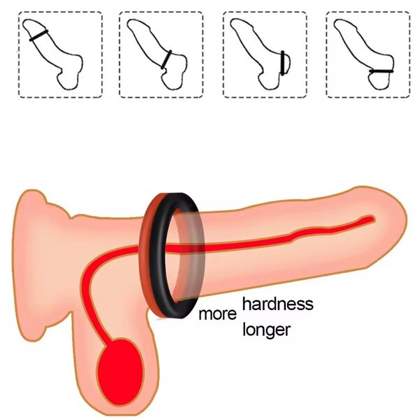 Anneaux Érectiles Silicone