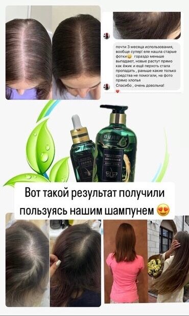Шампунь от выпадения волос и для роста
