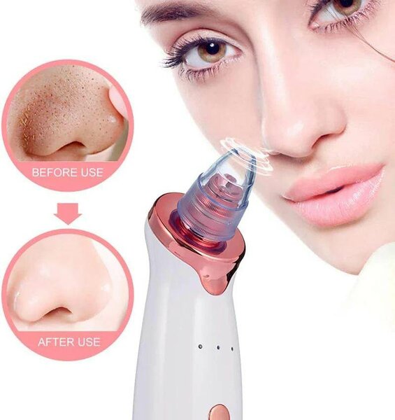 Aspirateur de points noires