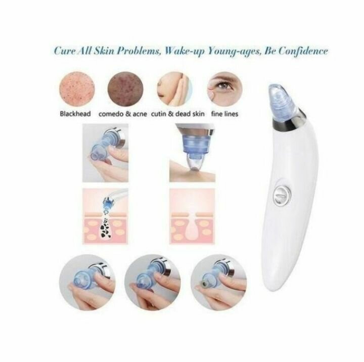 Aspirateur de graisse