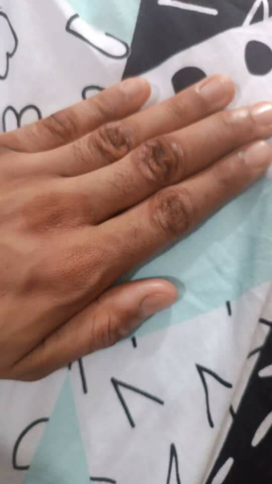 Huile peeling, quinto tâches