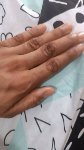 Huile peeling, quinto tâches