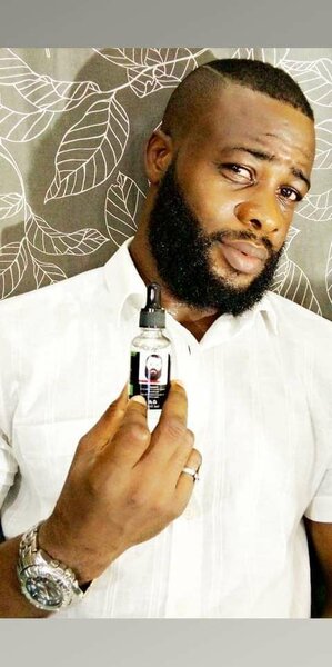 Fini avec la calvitie les chutes de cheveux  en 15 jours