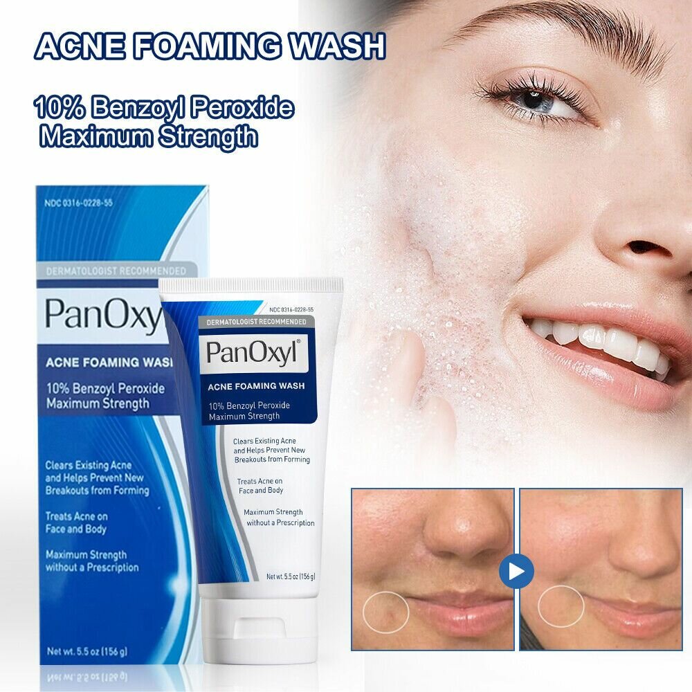 Panoxyl acne foam wash