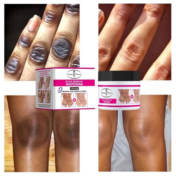 Dark knuckles removal