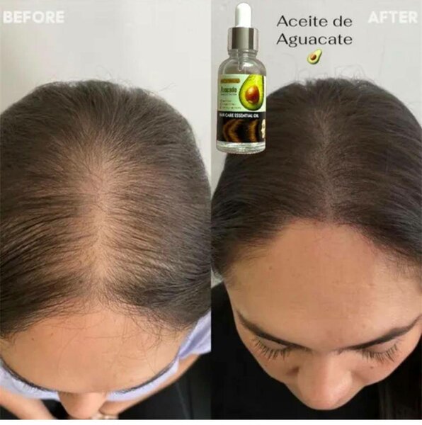 Avocado Hair Oil Elixir
