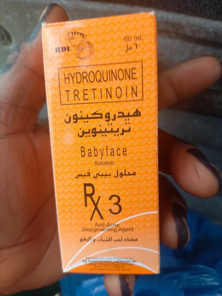 Rdl baby face solution