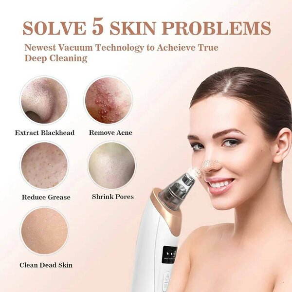 Aspirateur de Points Noirs