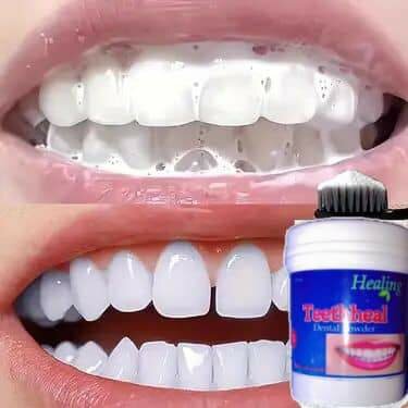 Poudre Dentaire Blancheur