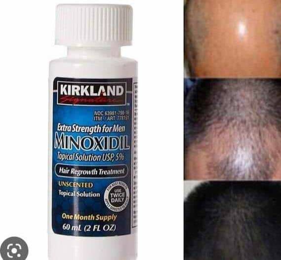 Great minoxidil Kirkland oil for hair beard growth