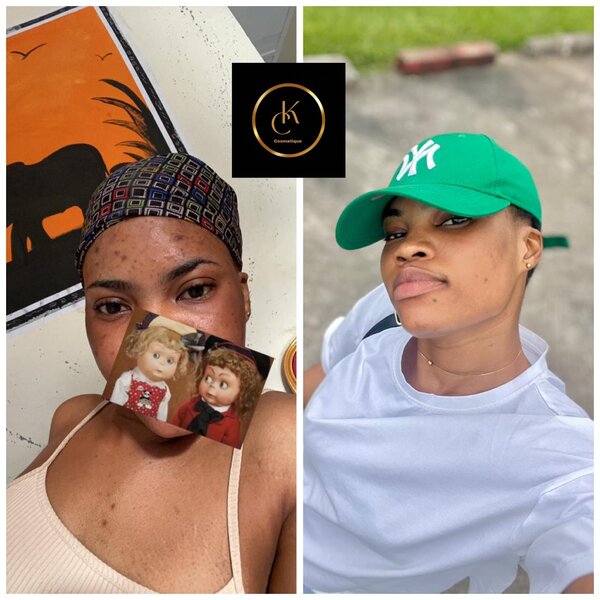 Savon Réparateur Éclat