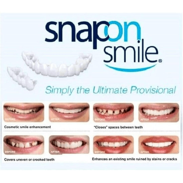 Snap on Fake Teeth
