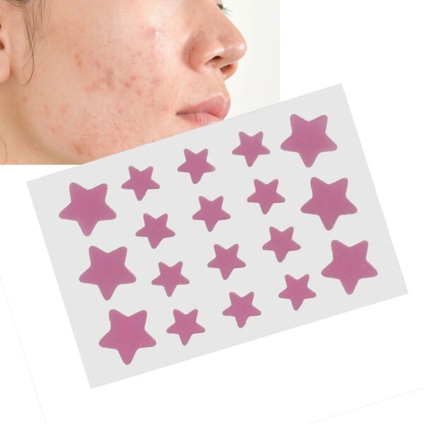 Patchs anti-acné étoiles