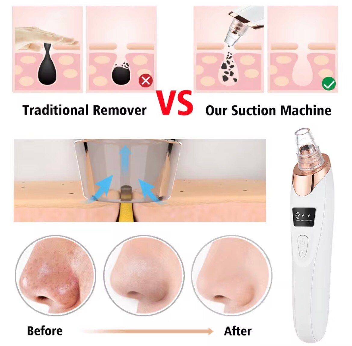 Aspirateur Points Noirs Électrique