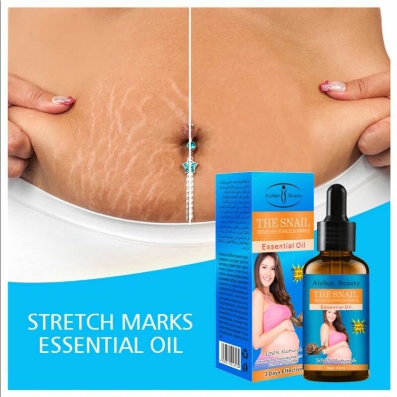 Snail Oil  - Reduces stretch marks, nourishes skin