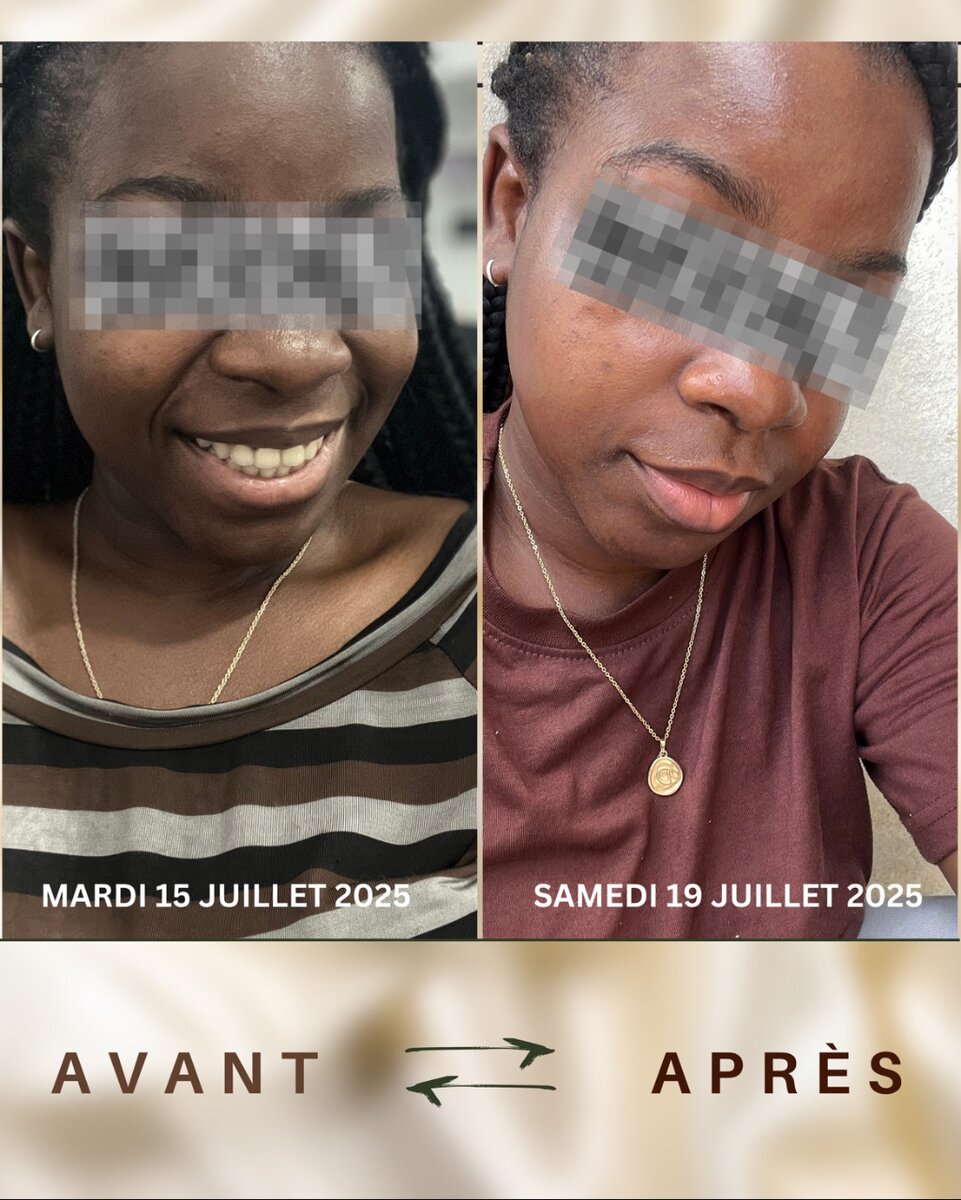 Savon Noir du Nigéria Original