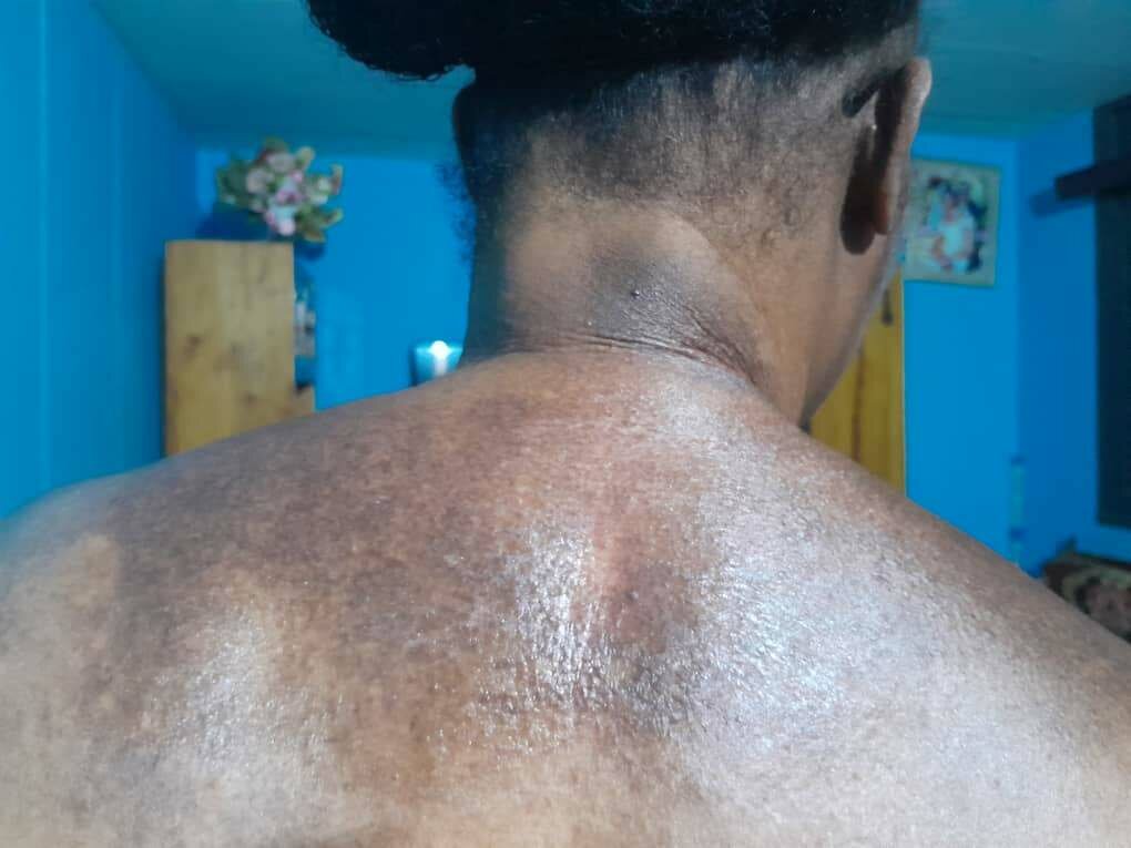 Kit Melano et lotion mami